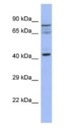 Slain2 Rabbit anti-Human, Polyclonal, Novus Biologicals 100 &mu;g | Buy Online | Novus Biologicals | Fisher Scientific